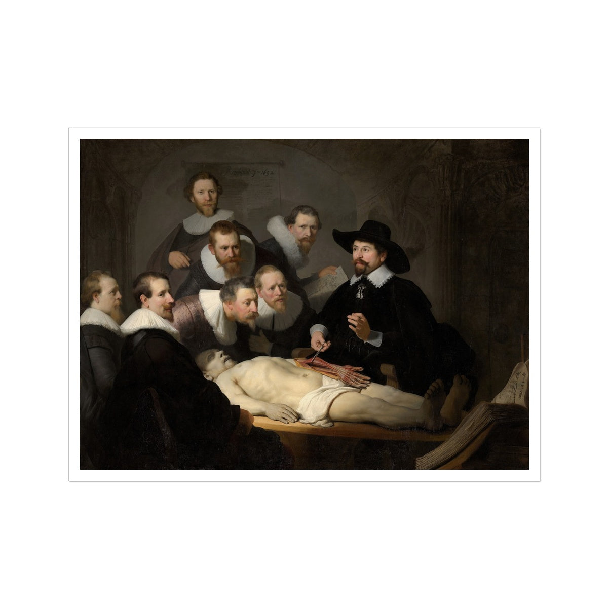 The Anatomy Lesson of Dr Nicolaes Tulp by Rembrandt van Rijn Fine Art Print